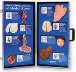 Konsekwencje nadużywania alkoholu Prezentacja 3D