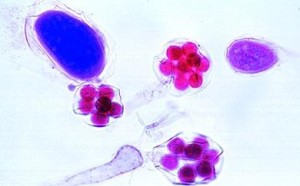 Zestaw 20 preparatów - przyczyny i skutki zanieczyszczenia wody 