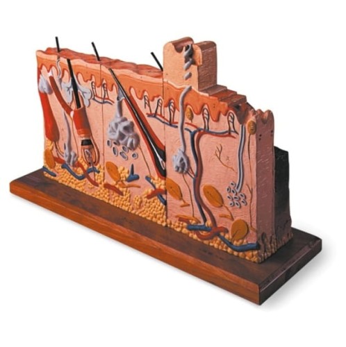 Skóra człowieka z patologią oparzeń model