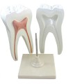 Ząb trzonowy – model dydaktyczny