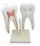 Ząb trzonowy – model dydaktyczny 