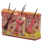 Skóra człowieka - model ze zmianami trądzikowymi 