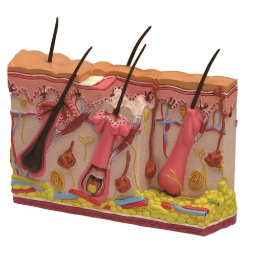 Skóra człowieka - model ze zmianami trądzikowymi