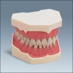 Mode szczękil F2 z pełnym uzębieniem 