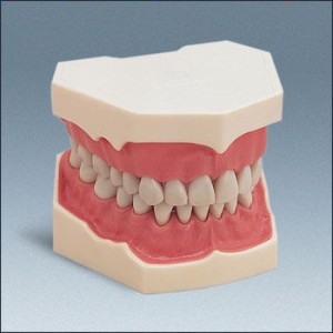 Mode szczękil F2 z pełnym uzębieniem 