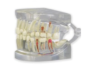 Przezroczysty model stomatologiczny – Anatomia i 15 patologii