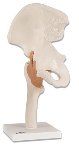 Staw biodrowy model 