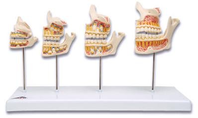 Fazy rozwoju uzębienia - model