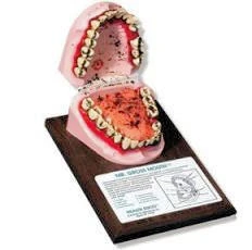 Jama ustna osoby żującej tytoń